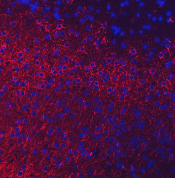 NEFL/NF-L/NF Rabbit Polyclonal Antibody