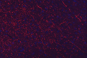 NEFL/NF-L/NF Rabbit Polyclonal Antibody