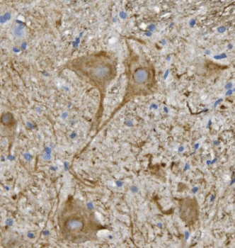 NEFL/NF-L/NF Rabbit Polyclonal Antibody