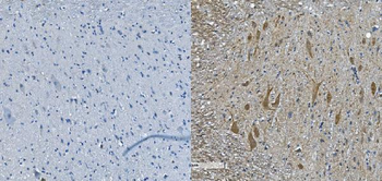 NEFL/NF-L/NF Rabbit Polyclonal Antibody