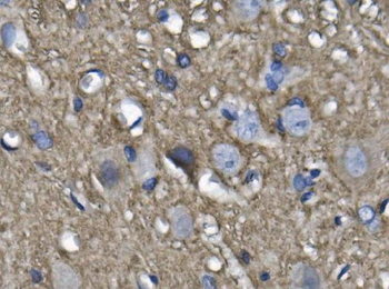 NEFL/NF-L/NF Rabbit Polyclonal Antibody