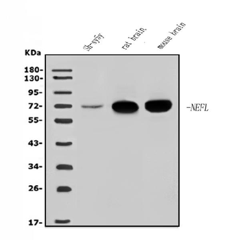 NEFL/NF-L/NF Rabbit Polyclonal Antibody