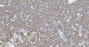 CARD4/NOD1 Rabbit Polyclonal Antibody