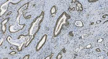 PARP/PARP1 Antibody (monoclonal, 2I2H4)