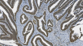 PARP/PARP1 Antibody (monoclonal, 2I2H4)