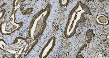 PARP/PARP1 Antibody (monoclonal, 10E11)