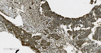 PARP/PARP1 Antibody (monoclonal, 10E11)