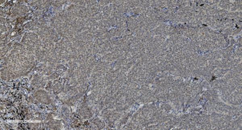 PARP/PARP1 Antibody (monoclonal, 10G9)