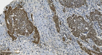 PARP/PARP1 Antibody (monoclonal, 10G9)