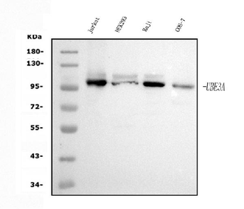 UBE3A Mouse Monoclonal Antibody