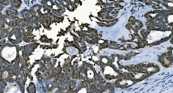 CDC45L Mouse Monoclonal Antibody