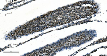 CDC45L Mouse Monoclonal Antibody