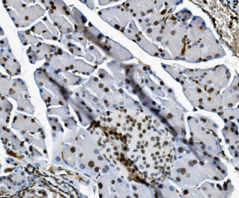 Transketolase/TKT Antibody (monoclonal, 3E5)