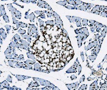 Transketolase/TKT Antibody (monoclonal, 3E5)