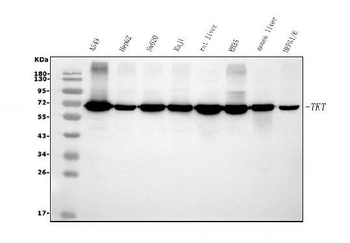 Transketolase/TKT Antibody (monoclonal, 3E5)