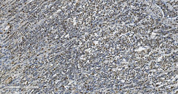 Transketolase/TKT Antibody (monoclonal, 3E5)