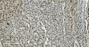 Transketolase/TKT Antibody (monoclonal, 3E5)