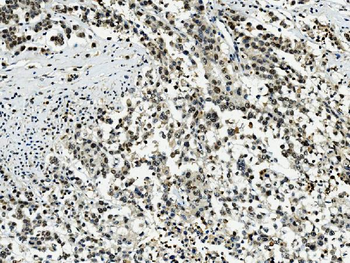 Transketolase/TKT Antibody (monoclonal, 2I3)