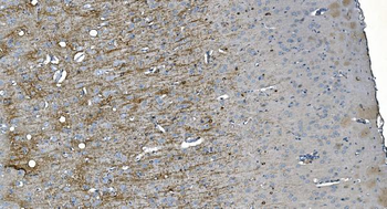 MAG Picoband® Mouse Monoclonal Antibody