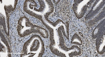 U2AF65/U2AF2 Picoband® Mouse Monoclonal Antibody