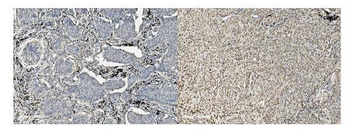 MCM5 Mouse Monoclonal Antibody