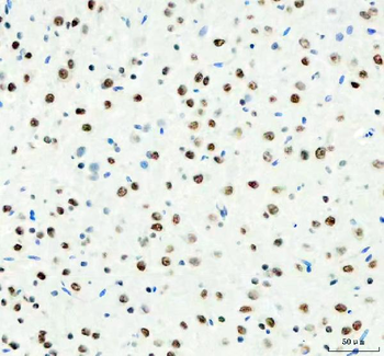 DDX1 Antibody (monoclonal, 3I10)