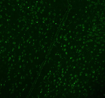 DDX1 Antibody (monoclonal, 3I10)