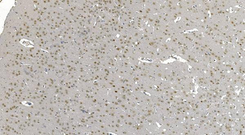 DDX1 Picoband® Mouse Monoclonal Antibody