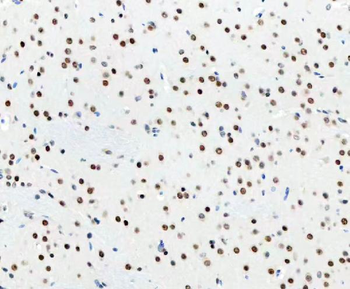 DDX1 Picoband® Mouse Monoclonal Antibody