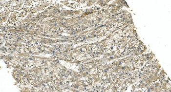 Tubulin alpha Antibody (monoclonal, 7B12)