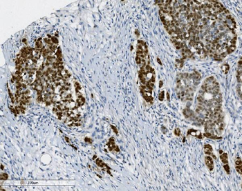 PTBP2 Mouse Monoclonal Antibody