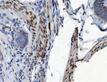 PTBP2 Mouse Monoclonal Antibody