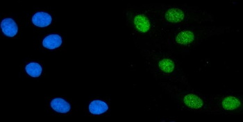 PTBP2 Mouse Monoclonal Antibody