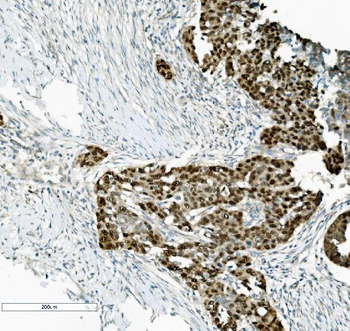 PTBP2 Mouse Monoclonal Antibody