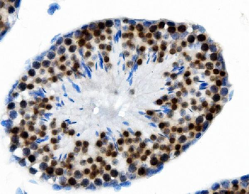 PTBP2 Mouse Monoclonal Antibody