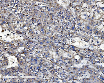 P Glycoprotein/ABCB1 Rabbit Polyclonal Antibody