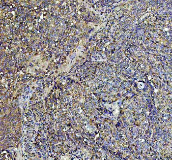 AGO3 Rabbit Polyclonal Antibody