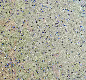 AGO3 Rabbit Polyclonal Antibody