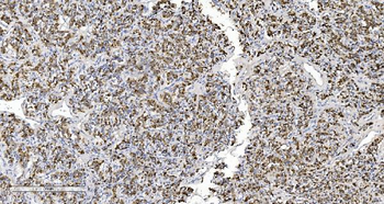 ARG2 Rabbit Polyclonal Antibody