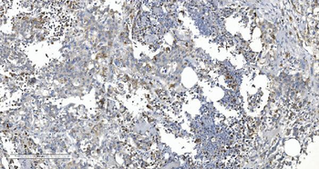 ARG2 Rabbit Polyclonal Antibody