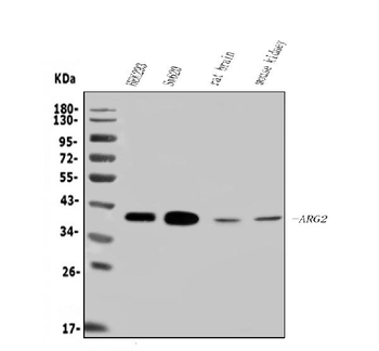 ARG2 Rabbit Polyclonal Antibody