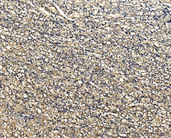 ATG9A Rabbit Polyclonal Antibody