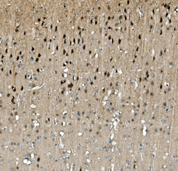 TORC1/CRTC1 Rabbit Polyclonal Antibody