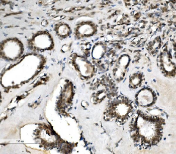 VPRBP/DCAF1 Rabbit Polyclonal Antibody