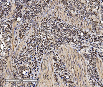 VPRBP/DCAF1 Rabbit Polyclonal Antibody