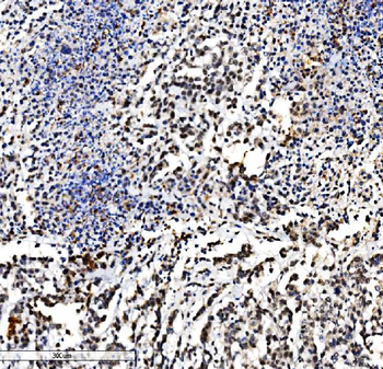 VPRBP/DCAF1 Rabbit Polyclonal Antibody
