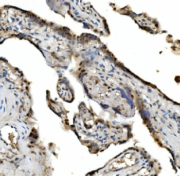 VPRBP/DCAF1 Rabbit Polyclonal Antibody