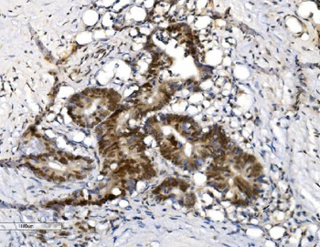 VPRBP/DCAF1 Rabbit Polyclonal Antibody