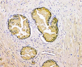Prostate Specific Antigen/KLK3 Rabbit Polyclonal Antibody