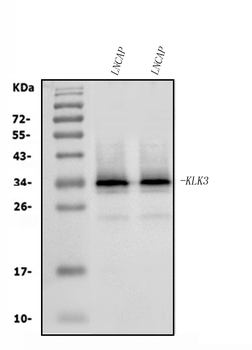 Prostate Specific Antigen/KLK3 Rabbit Polyclonal Antibody